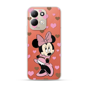 Silikonska Maskica za Redmi 17 - Cute Mouse