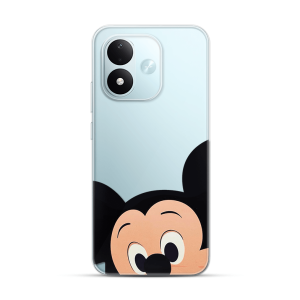 Silikonska Maskica za Redmi Note 17 4G/5G - Mouse Close Up