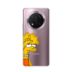 Silikonska Maskica za Honor Magic 7 Lite - L Stands For Loser