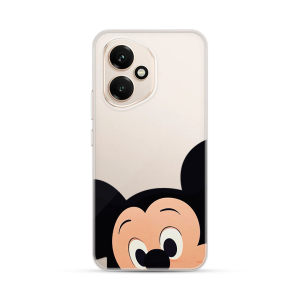 Silikonska Maskica za Honor 400 - Close Up