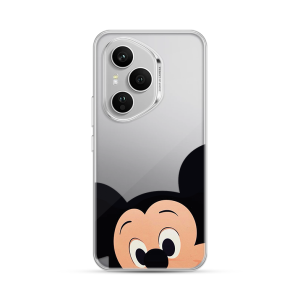 Silikonska Maskica za Honor 400 Pro - Close Up